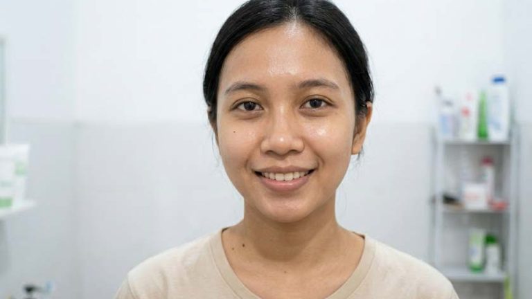 sesudah perawatan dengan minuman kolagen